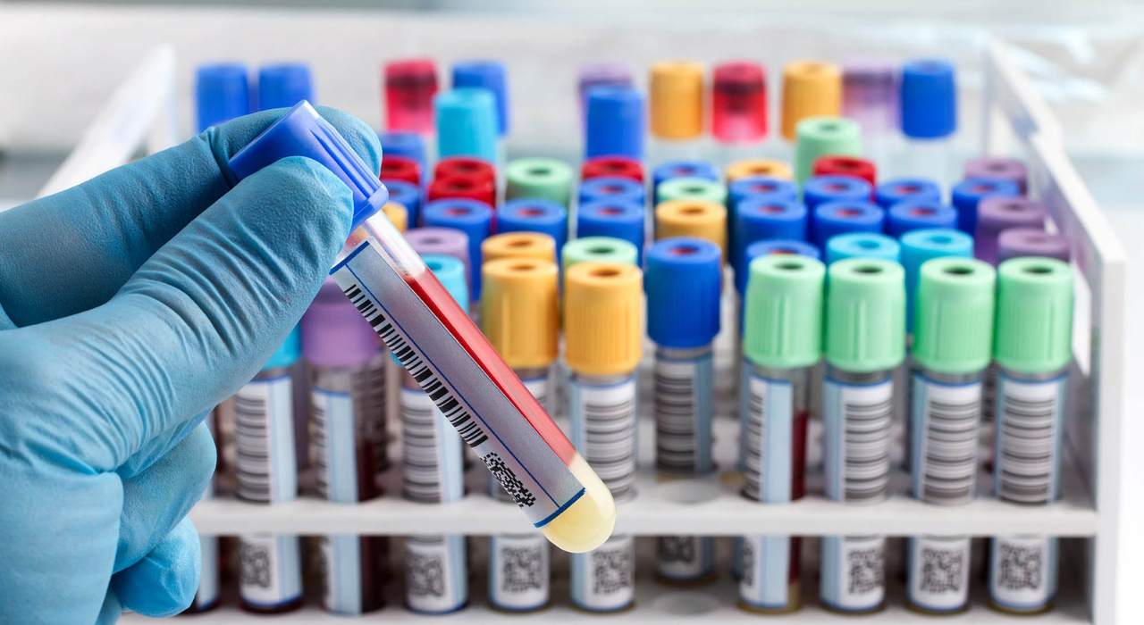 What Your Body is Telling You – Listen Through Lab Tests